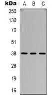 CYSLTR1 Rabbit Polyclonal Antibody