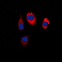 Anti-EDG5 Antibody