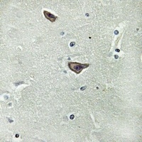Anti-GPR180 Antibody