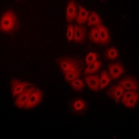 Anti-GPR180 Antibody