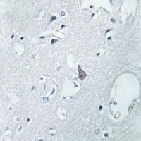Anti-Mu Opioid Receptor Antibody
