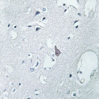 OPRM1 antibody