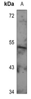 GIP Receptor Rabbit Polyclonal Antibody