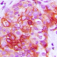 GIP Receptor Rabbit Polyclonal Antibody