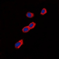 GIP Receptor Rabbit Polyclonal Antibody