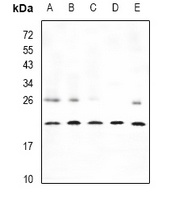 CPI17 Rabbit Polyclonal Antibody