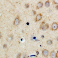 CPI17 Rabbit Polyclonal Antibody