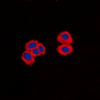 PPP1R14A antibody