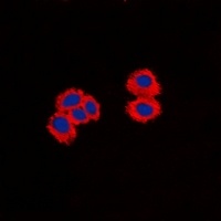 CPI17 Rabbit Polyclonal Antibody