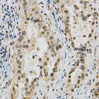 JUNB antibody