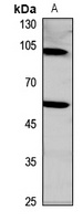 EGF Rabbit Polyclonal Antibody