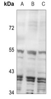 Inhibin beta C Antibody