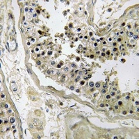 Inhibin beta C Antibody