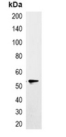 EYFP-tag antibody