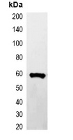 GST-tag Antibody