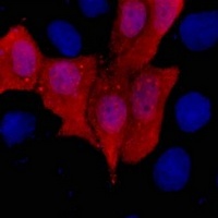 Anti-His-tag Antibody