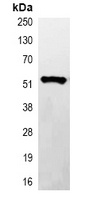 His-tag antibody