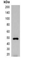 EYFP-tag Antibody