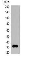 GFP-tag Antibody