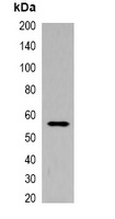 His-tag Antibody