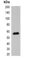 MBP-tag Antibody