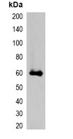 mStrawberry-tag Rabbit Polyclonal Antibody
