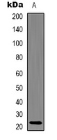 Alpha-crystallin C Mouse Monoclonal Antibody