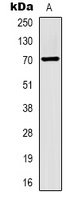 Alpha-fetoglobulin Antibody