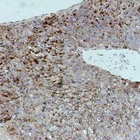 Alpha-fetoglobulin Antibody