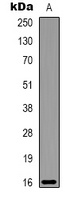 Alpha-lactalbumin Mouse Monoclonal Antibody