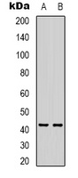AMACR Mouse Monoclonal Antibody