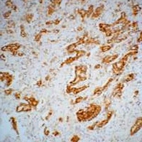 Anti-AMACR Antibody