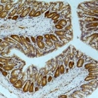Anti-AMPK alpha 1 Antibody