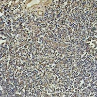 Beta1-tubulin Antibody