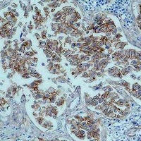 Anti-Beta-catenin Antibody
