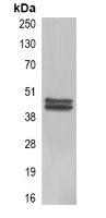 Carbonic Anhydrase 9 antibody