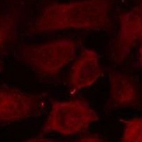 Anti-active Caspase 3 Antibody