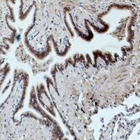Anti-CD16 Antibody