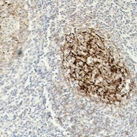 CD23 antibody