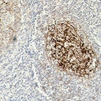 Anti-CD23 Antibody
