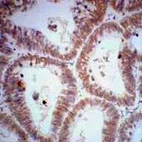 CDX2 Antibody