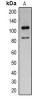 Cleaved PARP1 Antibody