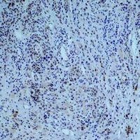 Collagen III antibody