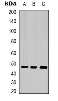 Cytokeratin 17 Mouse Monoclonal Antibody