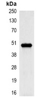 Cytokeratin 17 Mouse Monoclonal Antibody
