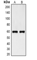 Cytokeratin 6 Mouse Monoclonal Antibody
