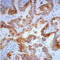 Anti-Cytokeratin 7 Antibody