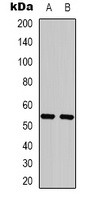 Cytokeratin 8 Mouse Monoclonal Antibody