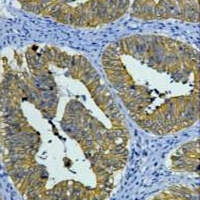 Cytokeratin 8 Mouse Monoclonal Antibody