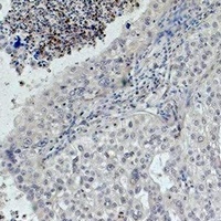 EGFR Antibody